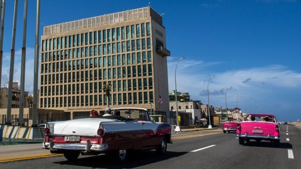  Une étude de 5 ans ne révèle aucune anomalie cérébrale chez les patients atteints du « syndrome de La Havane »